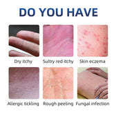 Anti-Fungal Skin Care Cream for Ringworm, Eczema & Itching