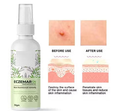 Anti-Fungal Skin Care Cream for Ringworm, Eczema & Itching