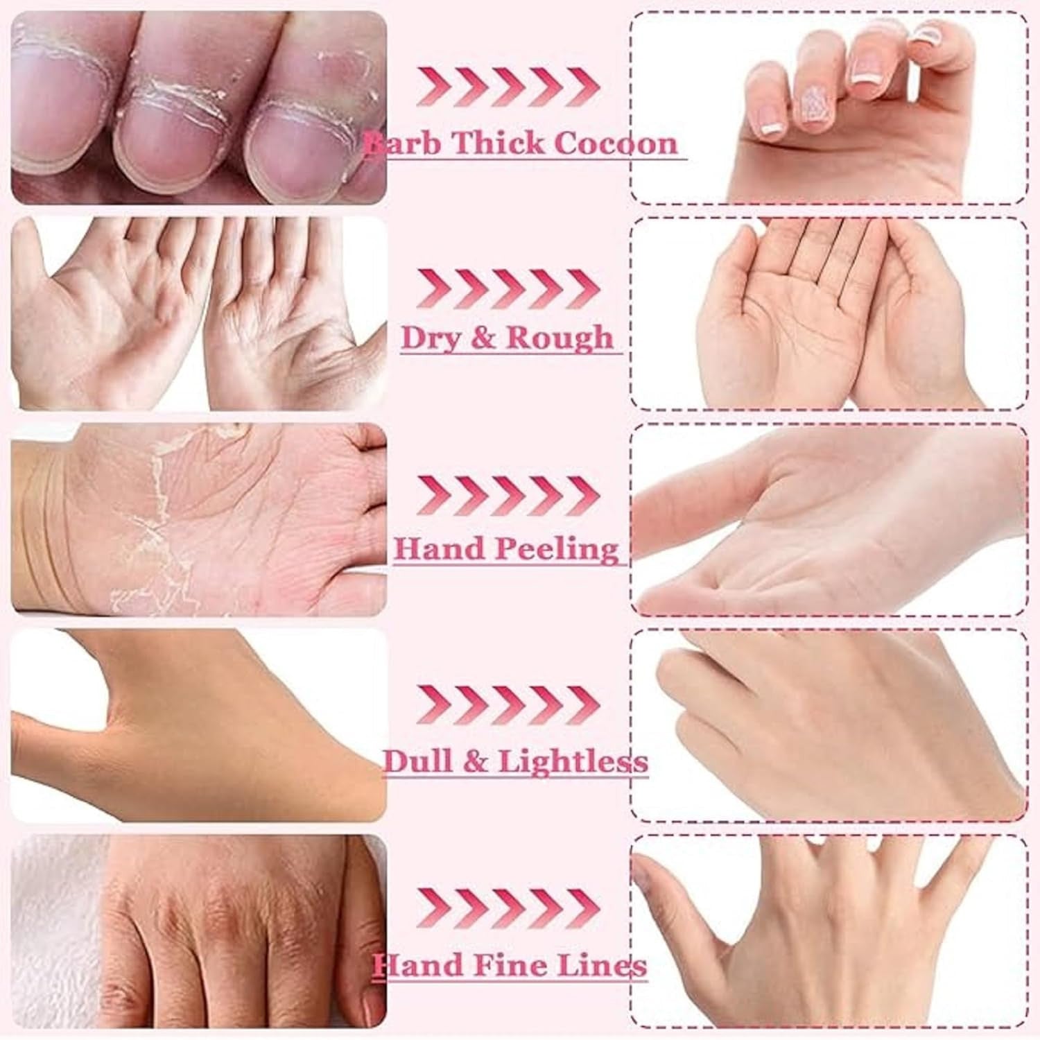 Moisturizing Hand Peel Mask Gloves for Soft, Smooth Hands