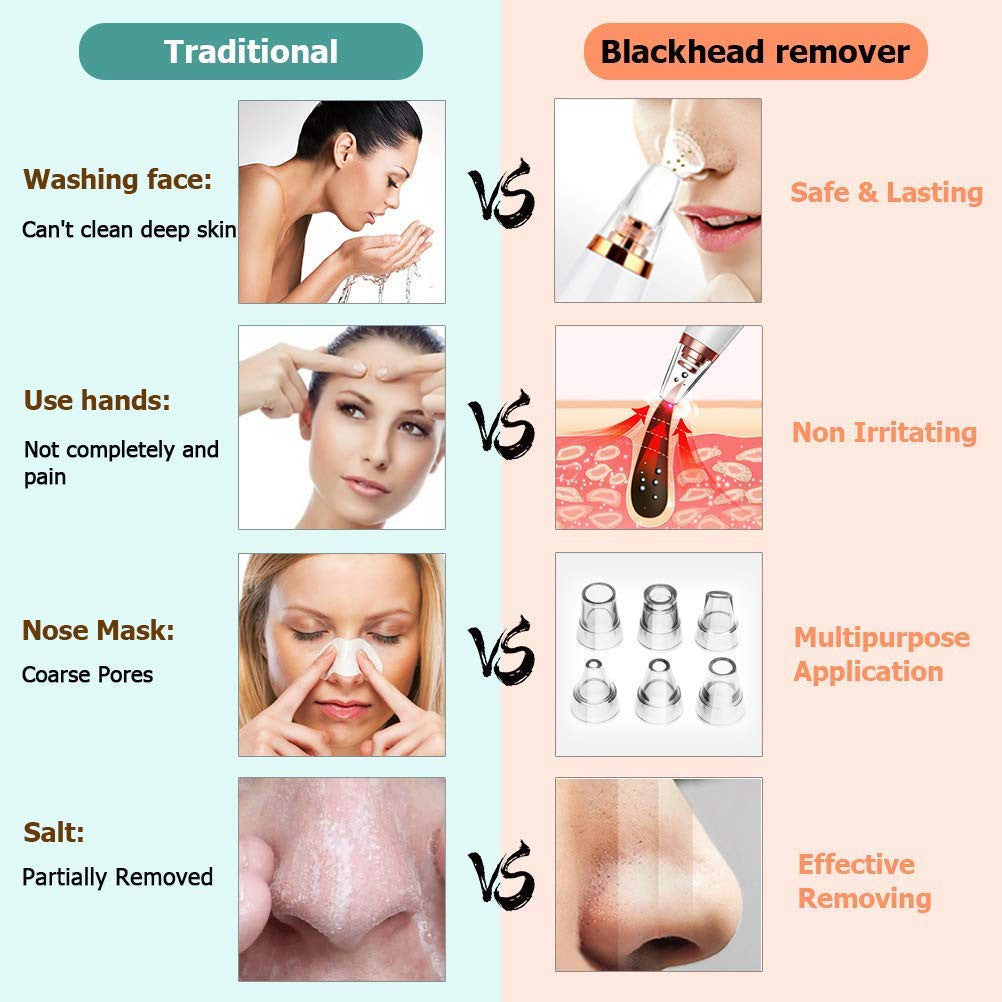 6-in-1 Multi-Function Blackhead Remover & Derma Suction Tool