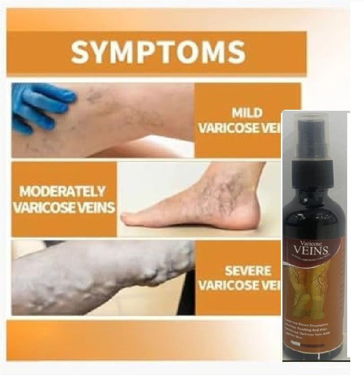Herbal Varicose Veins Relief Spray for Pain & Swelling