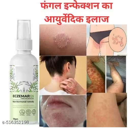 Anti-Fungal Skin Care Cream for Ringworm, Eczema & Itching