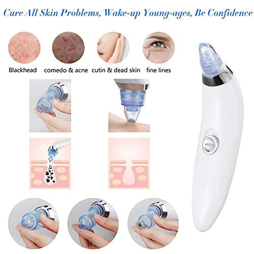 DermaSuction Blackhead & Pore Cleaner Kit with 4 Tips, Adjustable Intensity