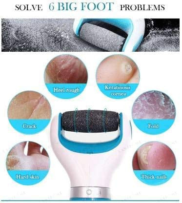 Foot Scrubber for Dead Skin Removal and Cracked Heel Care