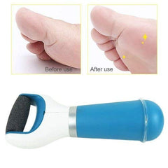 Foot Scrubber for Dead Skin Removal and Cracked Heel Care