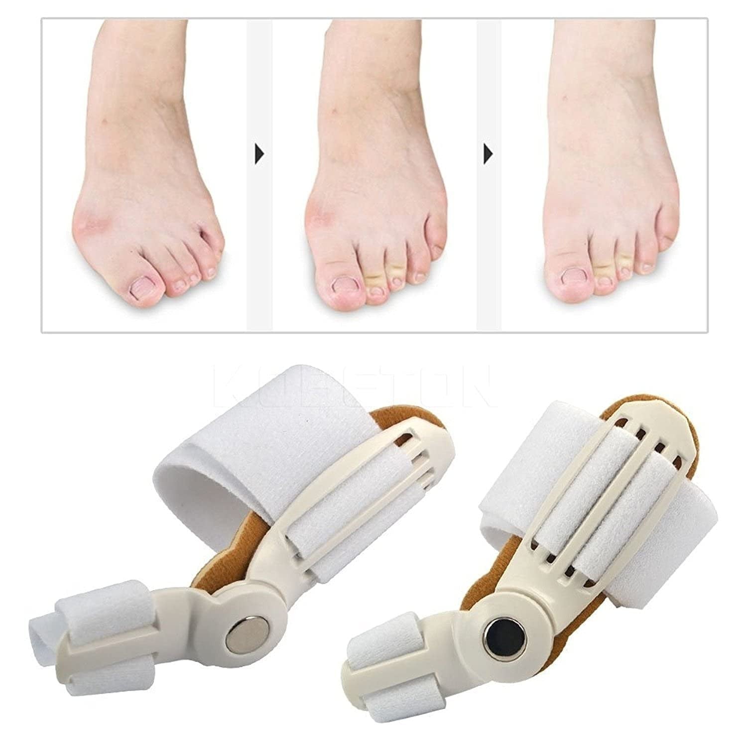 Toe Straightener Bunion Corrector Splint for Pain Relief & Foot Support