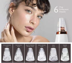 6-in-1 Multi-Function Blackhead Remover & Derma Suction Tool
