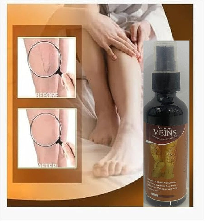 Herbal Varicose Veins Relief Spray for Pain & Swelling