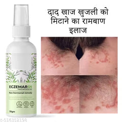 Anti-Fungal Skin Care Cream for Ringworm, Eczema & Itching
