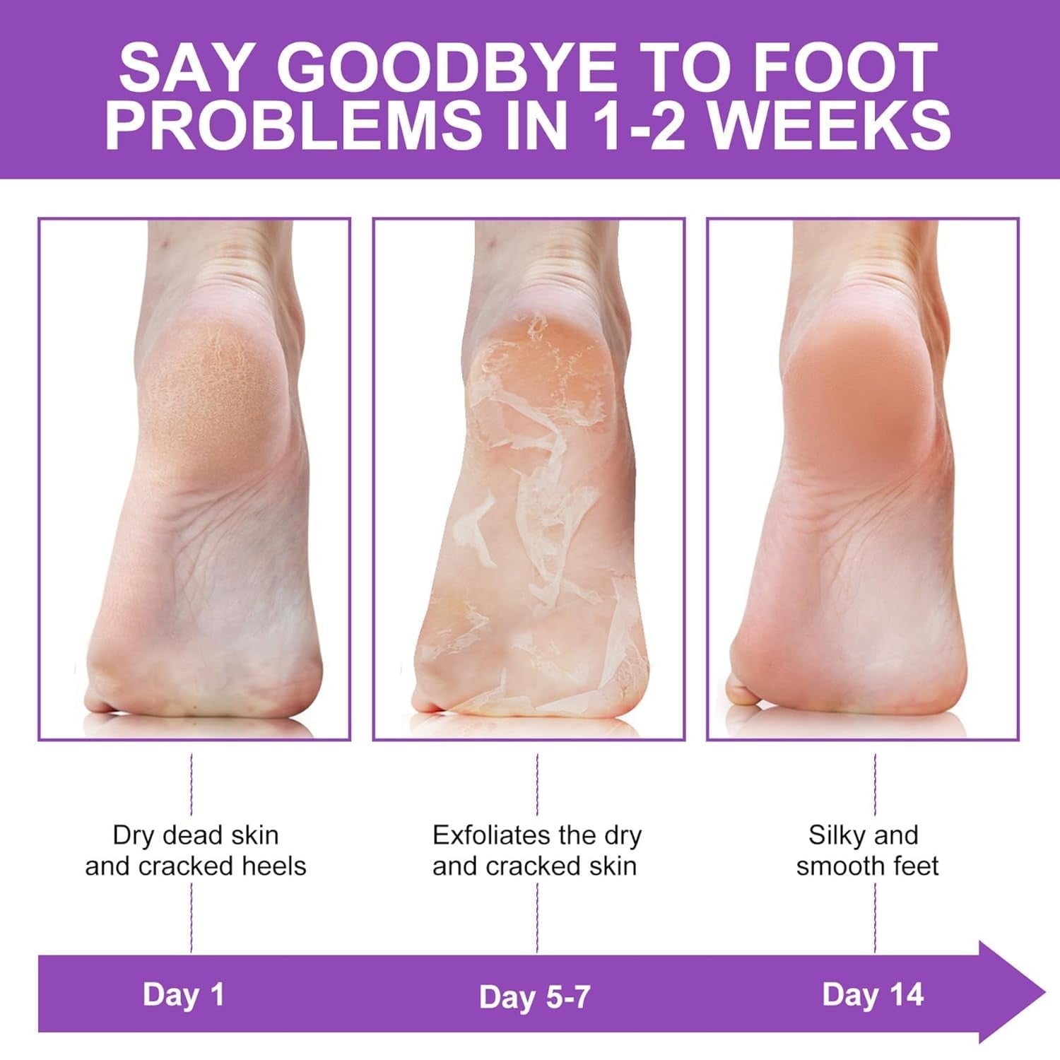 Hydrating Foot Peel Mask for Smooth, Soft Feet