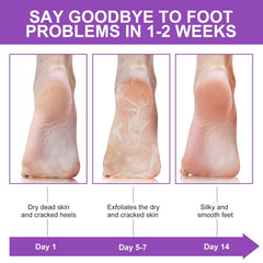 Hydrating Foot Peel Mask for Smooth, Soft Feet