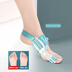 Advanced Toe Straightener for Perfect Alignment and Comfort