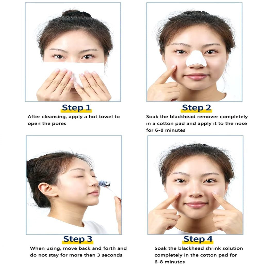 DermaSuction Blackhead & Pore Cleaner Kit with 4 Tips, Adjustable Intensity
