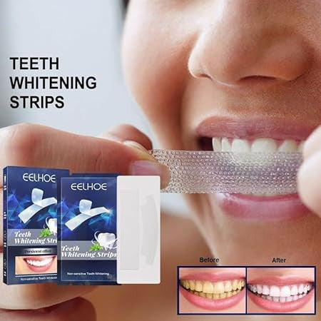 BrightSmile Teeth Whitening Strips for a Radiant Smile