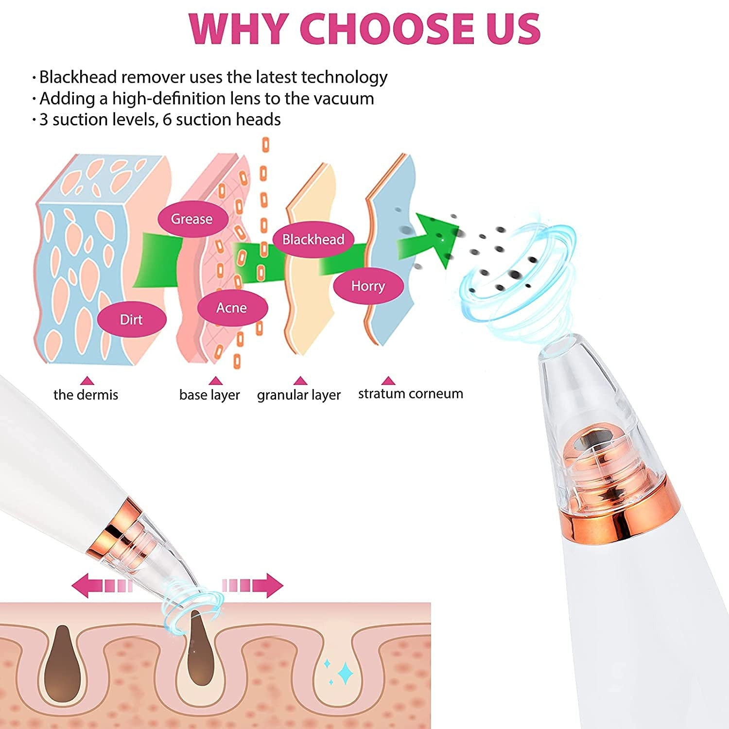 6-in-1 Multi-Function Blackhead Remover & Derma Suction Tool