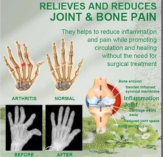 Bee Venom Pain Relief Cream for Fast, Natural Relief