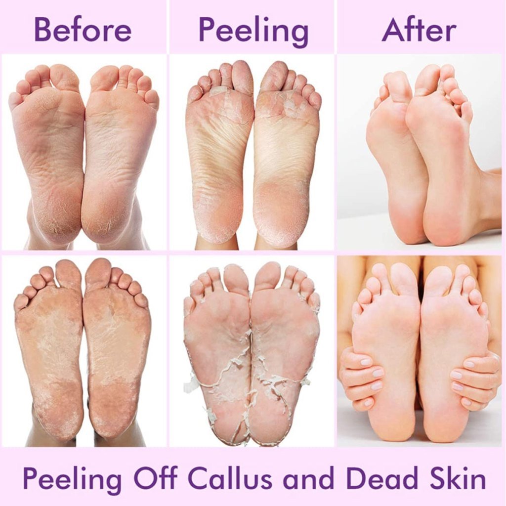 Revitalizing Foot Peeling Mask – Dead Skin Remover & Moisturizer Socks (Lavender, 1 Pair)