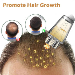 10ml Hair Oil Applicator Bottle – Anti-Leak Scalp & Hair Loss Dispenser
