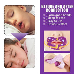 Anti Snoring Lips Strips – 30 Pcs Breathable Mouth Tape for Adults & Kids